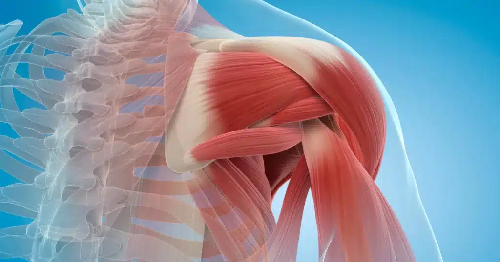 3D anatomical illustration showing shoulder joint muscles and connective tissues, highlighting areas where muscle guarding occurs and why a routine stretch may not provide lasting relief | Port Perry Wellness Centre